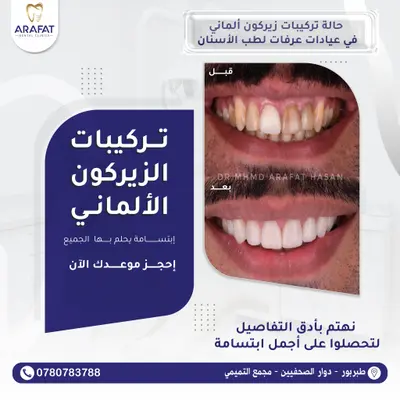 الدكتور محمد عرفات حسن أفضل طب أسنان في عمّان طبربور - بوستات دعائية