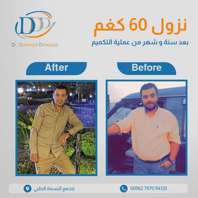 عيادة عيادة الدكتور داوود داوود الدكتور داوود داوود أفضل جراحة عامة في عمّان جبل عمّان - حالات علاجية