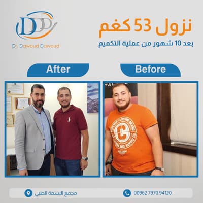 عيادة عيادة الدكتور داوود داوود الدكتور داوود داوود أفضل جراحة عامة في عمّان جبل عمّان - حالات علاجية