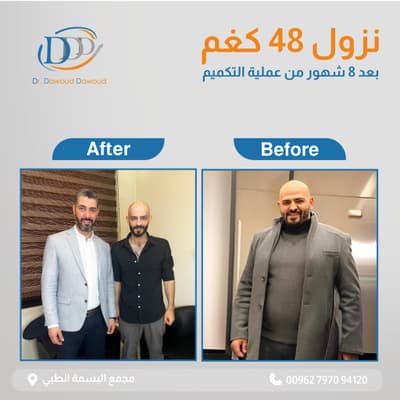 عيادة عيادة الدكتور داوود داوود الدكتور داوود داوود أفضل جراحة عامة في عمّان جبل عمّان - حالات علاجية